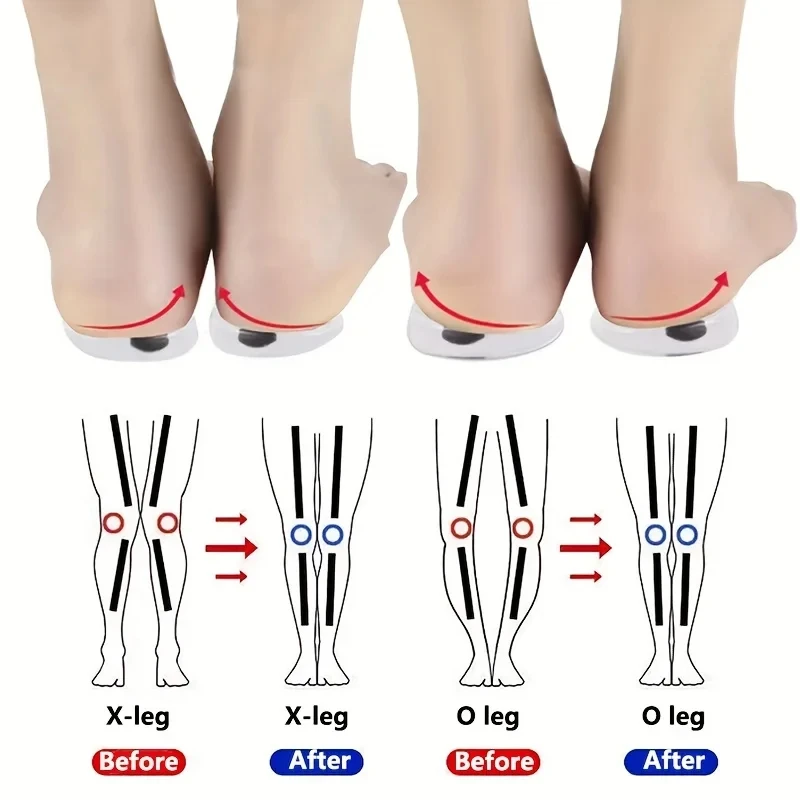 Women Shoes Types - 1 pasang sol dalam ortopedi untuk