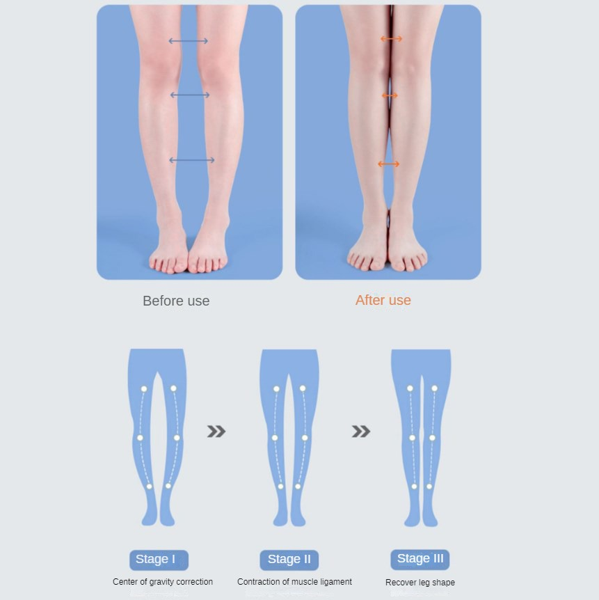 PU Orthotic sol dalam dukungan - Women Shoes Types ulasan dan harga